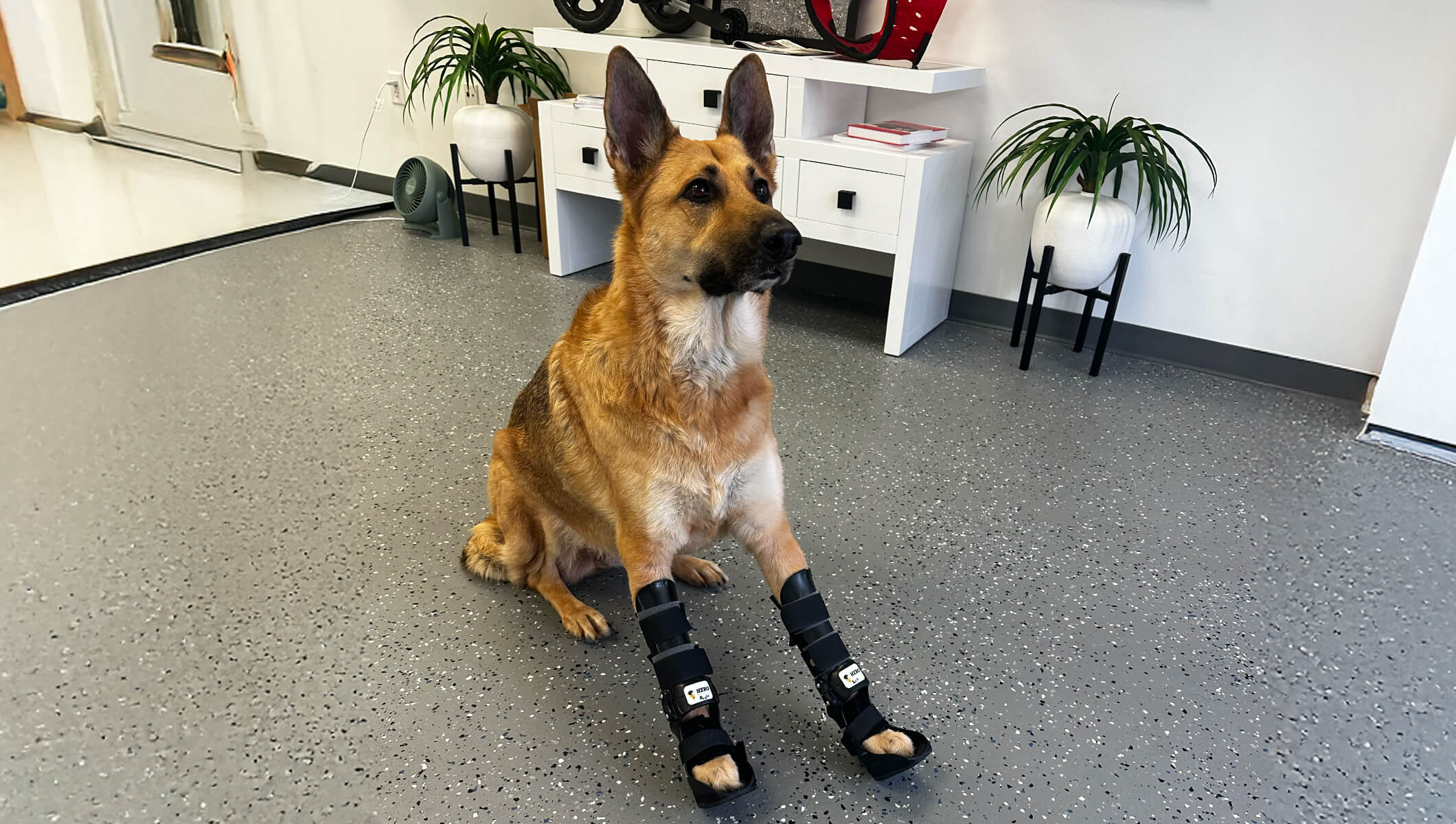 Reyna’s Journey: Overcoming Bilateral Carpal Hyperextension with Custom Bracing